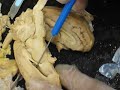 Septum Pellucidum