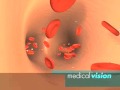 medicalvision Showreel medicalvision Showreel