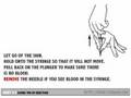 How to inject intramuscularly: Giving the Injection