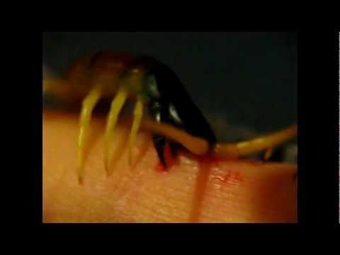 how to cure centipede bite