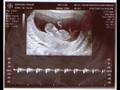 Baby Taberski