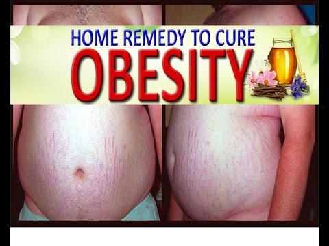 how to cure obesity