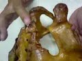 pelvic (doc mendoza) part 2 pelvic (doc mendoza) part 2