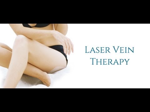 how to get rid veins on feet