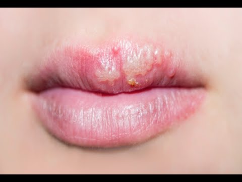 how to get rid of a virus illness
