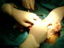 surgery Peru