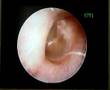Ear Clean