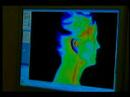 Digital Infrared Thermal Imaging DITI