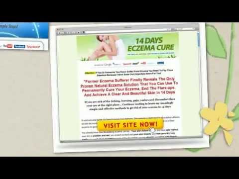 how to help eczema on face