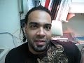 PATIENT WITH ADVANCED KERATOCONUS SPEAKING IN CREOLE