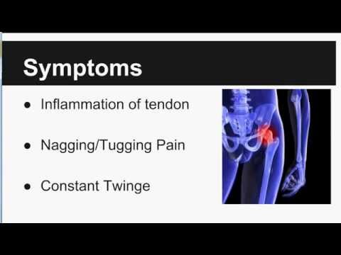 how to treat iliopsoas tendonitis