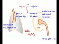 Respiratory Acidosis Compensated