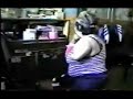 russian amputee