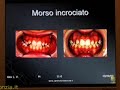 4 - Obiettivi di un trattamento tra i 7 e i 10 anni - (1/3)