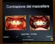 4 - Obiettivi di un trattamento tra i 7 e i 10 anni - (1/3)