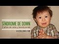 Sindrome-Down-2-a-os