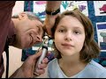 Fragile X Syndrome