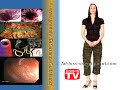 Worms Plaque And Parasites  Are Why Your Sick Fat And Tired