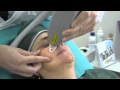 laser vascolare