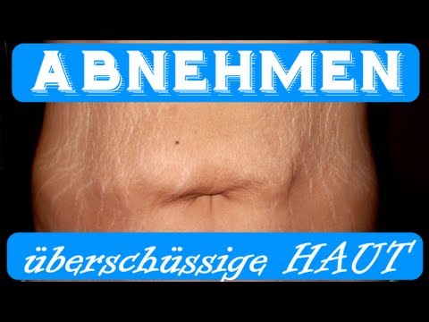 Abnehmen und überschüssige Haut verlieren (schnell Abnehmen) - KARL-ESS.COM