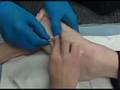 Foot IV