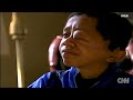 Boy with Head Tumor Gets New Face