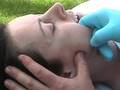 default TMJ Jaw Pain Treated with Chiropractic Type Therapies