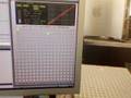Molar VST