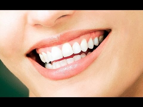 how to whiten extremely yellow teeth