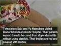 videos de Curing Atopic Dermatitis - www.HealthInWater.Homestead.com 1(866)620-9371 - Kangen Water