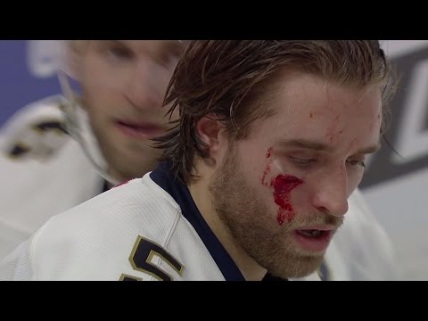 Video: Gotta See It: Ekblad shaken after taking puck to the face