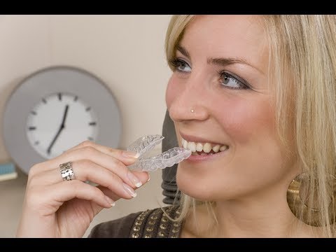 how to fasten braces treatment