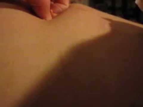 how to drain your own cyst
