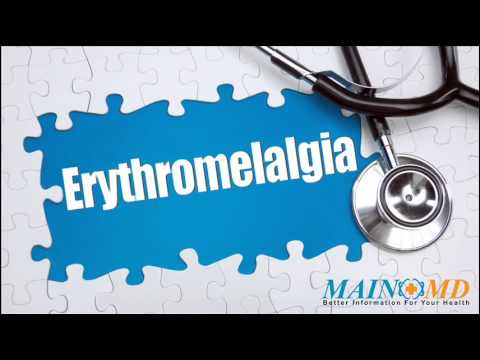 how to cure erythromelalgia