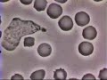 Glóbulo Blanco Persiguiendo a una Bacteria