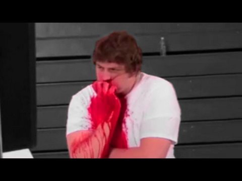 how to stop a huge nose bleed