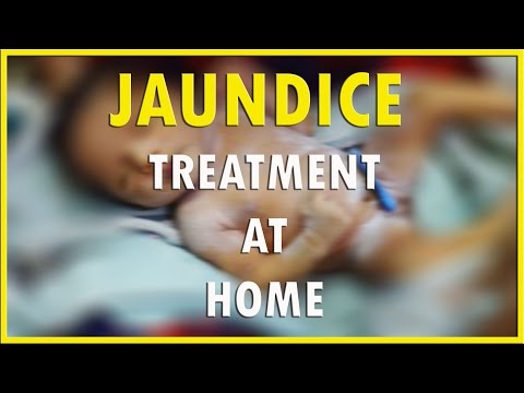 how to get rid jaundice in newborns
