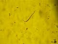 Nematode