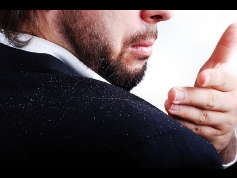 how to control dandruff at home