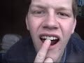 Before going to the dentist