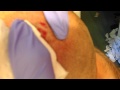 Head abcess/cyst Part III