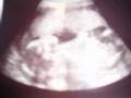 videos de MY PREGNANCY - EVERY BABY...