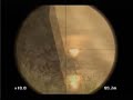 Socom Clan Wars