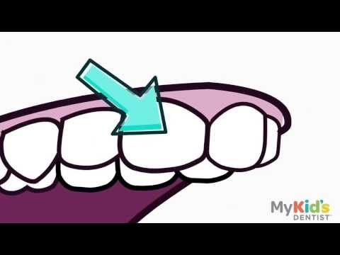 how to properly whiten your teeth