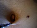 navel