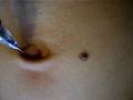 navel