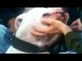 NEW! DOG(Argentine Mastiff) BITES KYLE DYER ...