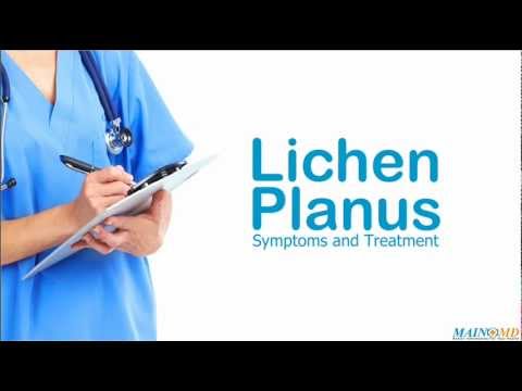 how to cure lichen planus