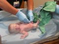 Twin Birth Story