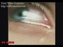 AIRBARG - ESTA NOCHE